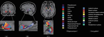 Correlation Between Decreased Amygdala Subnuclei Volumes and Impaired Cognitive Functions in Pediatric Bipolar Disorder